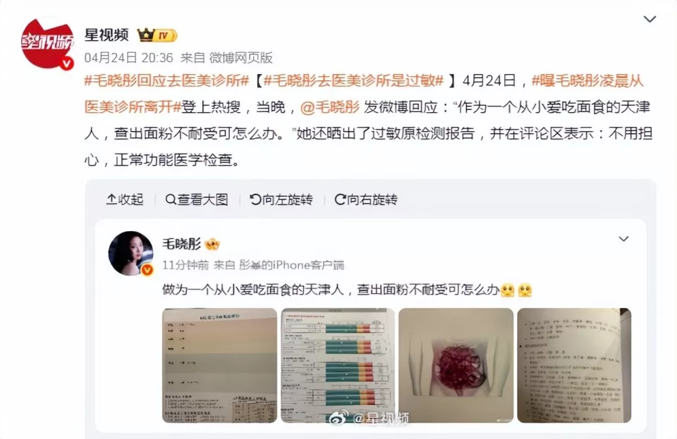 毛晓彤否认医美:对比7位"当红花"的出道照一目了然